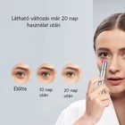 Kép 6/6 - Ionizáló fény- és hőterápiás arcmasszírozó készülék