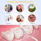 Kép 3/8 - Szájöblítő fogászati vízsugár 300 ml víztartállyal, IPX7 vízálló fogtisztító, USB  tölthető (Mornwell D52)
